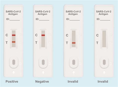 Antigen Test