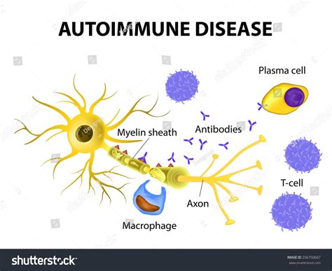 Autoimmune Disease Multiple Sclerosis Immune Cells Stock Illustration 256750687