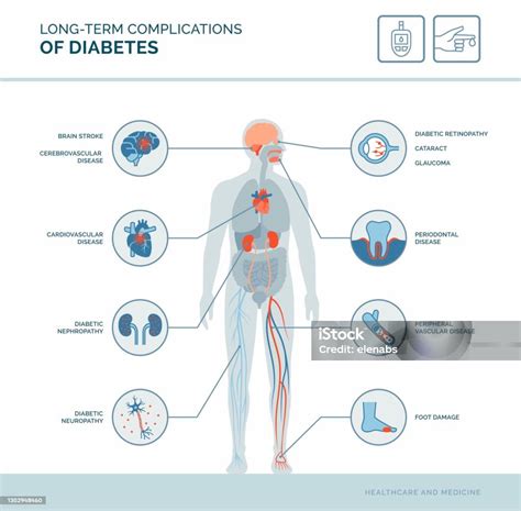 Complicanze A Lungo Termine Del Diabete - Immagini vettoriali stock e altre immagini di Il corpo ...