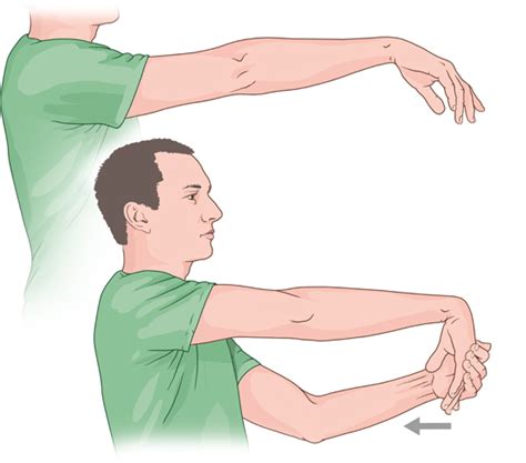 Tennis elbow: Strengthening and stretching exercises - InformedHealth.org - NCBI Bookshelf ...