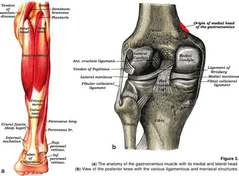 Gastrocnemius Tendon