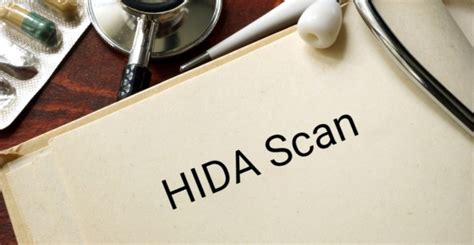 All About HIDA Scans - Facty Health