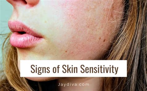 7 Signs of Skin Sensitivity you should know about - Jaydiva