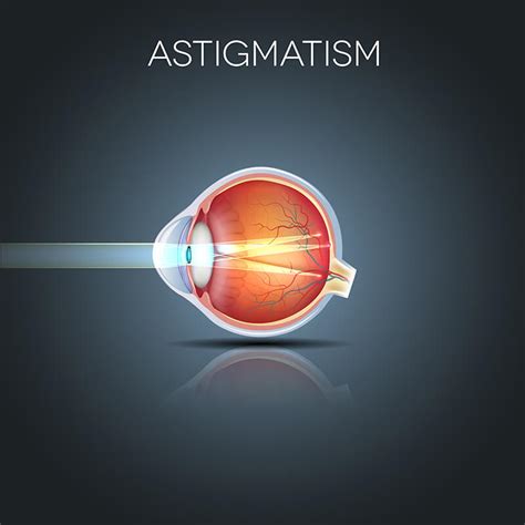 Ophthalmologist New York City | Vision Disorders | NY Eye