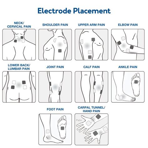 The 2023 Ultimate Guide to TENS Units | Nerve pain relief, Tens and units, Tens unit therapy
