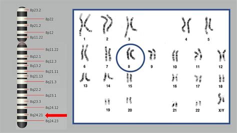 Research Story Tip: Genetic Marker for Prostate Cancer Found to Be Common Among Black Males