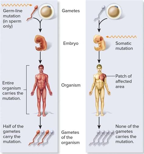 Peritoneum function layers anatomy relations of lesser sac and boundaries of epiploic foramen ...