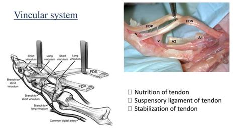 Tendon repair