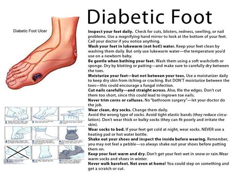 Symptoms of a Diabetic Foot one should know #diabeticfeet | For your Diabetes | Pinterest | Feet ...