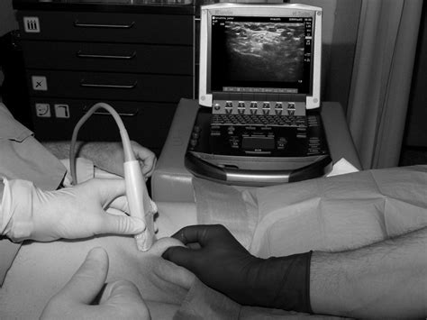 Ultrasound-guided spermatic cord block for scrotal surgery - British Journal of Anaesthesia