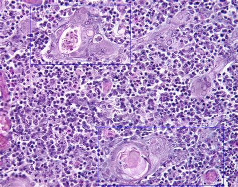 Hassall's Corpuscle of Thymus at 400X Magnification