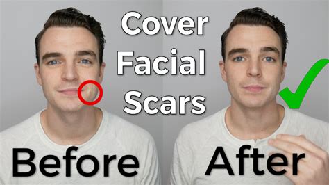 How to Cover Facial Scars with Men's Concealer — The Peak Lapel