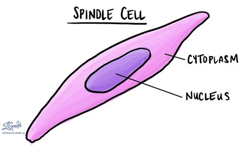 Spindle cell neoplasm | MyPathologyReport.ca