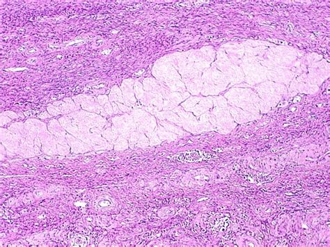 Ovary, Postovulation | Microanatomy Web Atlas | Gwen V. Childs, Ph.D.