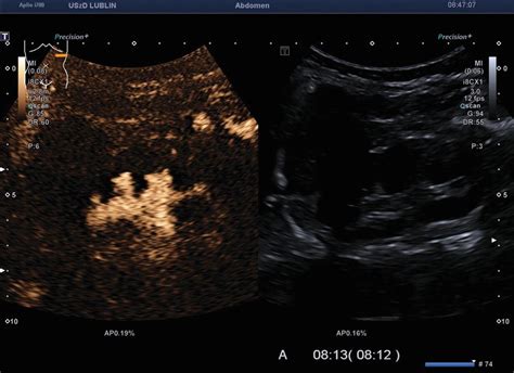 Principles of Doppler and Color Doppler Ultrasound | Pocket Dentistry