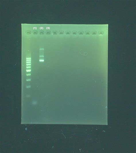 Can any one help me with explaining this gel electrophoresis result ...