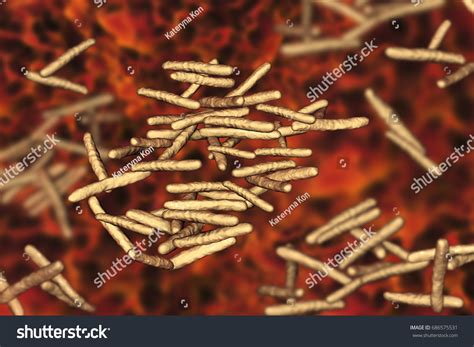 46 Mycobacterium avium complex Images, Stock Photos & Vectors | Shutterstock