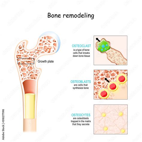 bone remodeling process. Osteoblast, osteoclast, and osteocyte. Stock ...