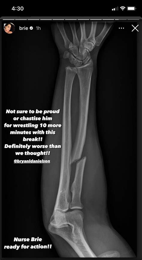 PHOTO: Bryan Danielson's Forbidden Door Injury 'Worse Than Thought' - WrestleTalk