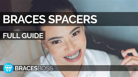 Braces Spacers - Full Pro Guide 2022 - BracesBoss