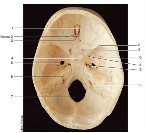 Figure 9.10 Superior view of floor of cranial cavity Diagram | Quizlet