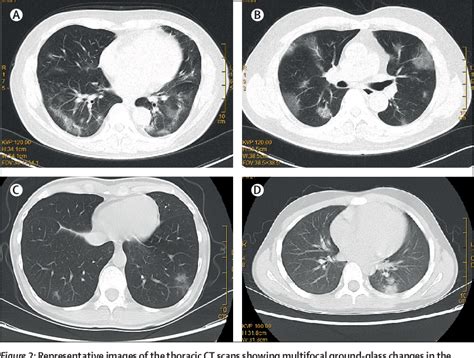 Vertical Disease Transmission | Semantic Scholar