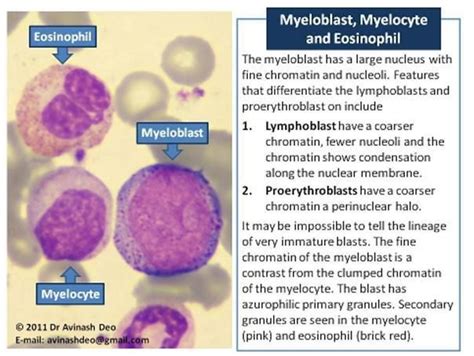 Myelocyte Vs Promyelocyte | Hematology, Morphology, Medical laboratory science