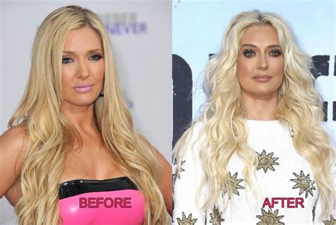 PHOTOS: See RHOBH's Erika Jayne Plastic Surgery Before & After Pics!