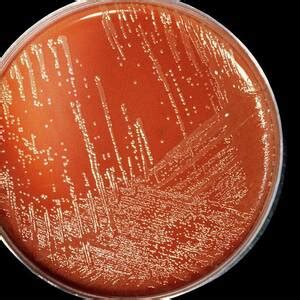 Neisseria Meningitidis Bacteria Photograph by Pasieka