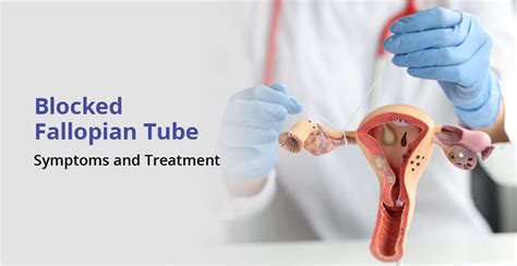 Blocked Fallopian Tubes: Causes, Symptoms and Treatment | Birla Fertility & IVF