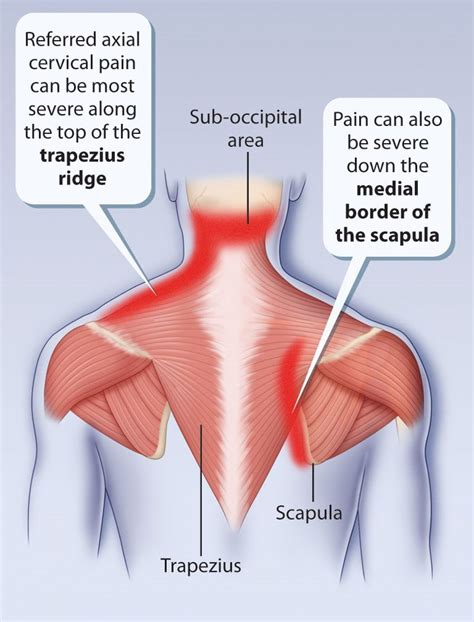 Got Shoulder Pain? Don’t be surprised if your massage therapist starts ...