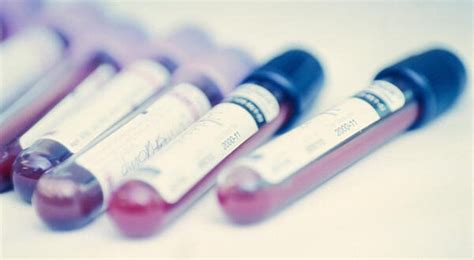 Paraproteinemia Definition, Symptoms, Causes, Treatment