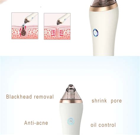 Home Microdermabrasion Machine Nose Pore Vacuum Cleaner Blackhead ...