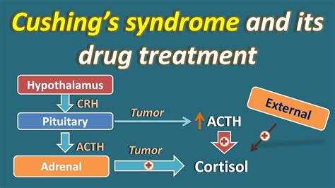 Cushing's syndrome and its treatment - YouTube