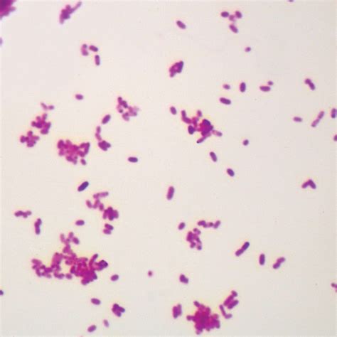 Salmonella typhimurium, w.m. Microscope Slide | Carolina Biological Supply