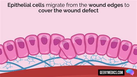 Wound Healing | Stages of Wound Healing | Geeky Medics