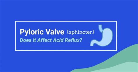 Pyloric Valve – An Important Sphincter That Affects Acid Reflux?