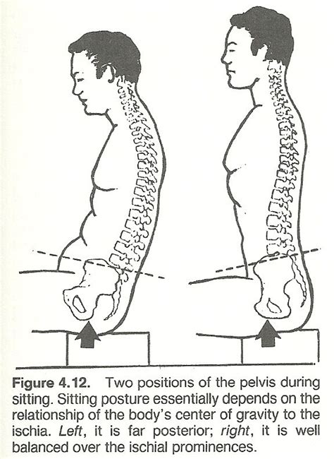 CHAPTER 4: BODY ALIGNMENT, POSTURE, AND GAIT | Hip workout, Postures, Hips