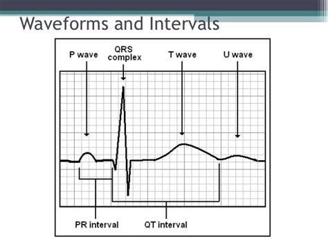 Ecg for beginners