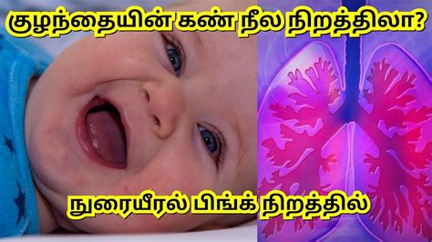 Baby eyes always blue colour. Some human facts in tamil. - YouTube