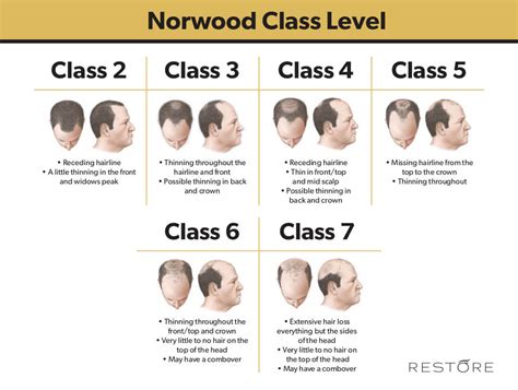 Norwood Scale for Balding - Norwood Chart | RESTORE Hair