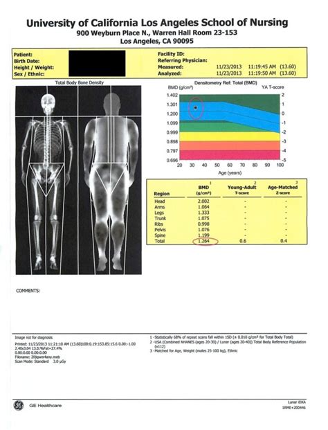 My DEXA Scan for Body Composition – BJJ Caveman