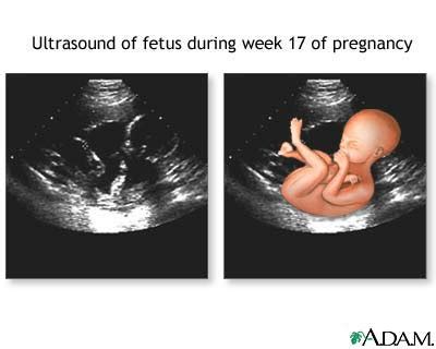 BABY BABBLE: 17 WEEKS DOWN, 23 TO GO!