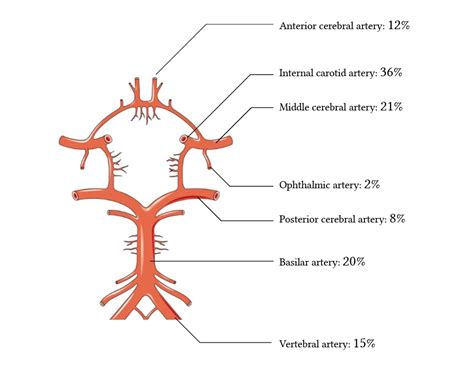 Cerebral blood flow autoregulation | Deranged Physiology