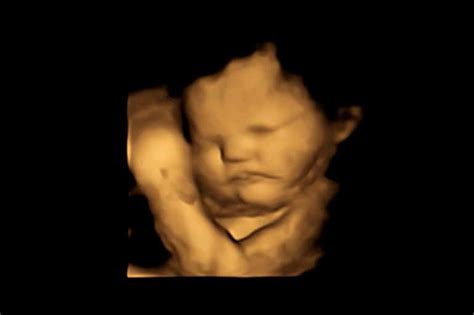 First Direct Evidence That Babies React to Taste and Smell in the Womb ...