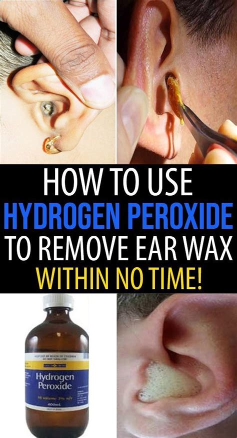 Your Ears Can Indicate Your Health, Never Ignore These Earwax | Clean ...