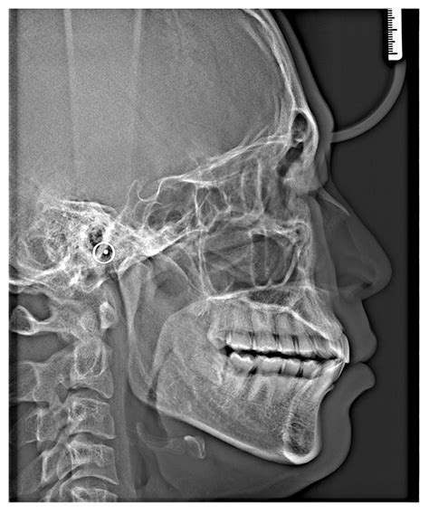 ApexPan-Panoramic-Xray-Cephalo-SC-Lateral - DentalStore123.com