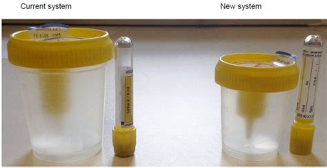 Bence Jones Protein (Urine) Exeter Clinical Laboratory International