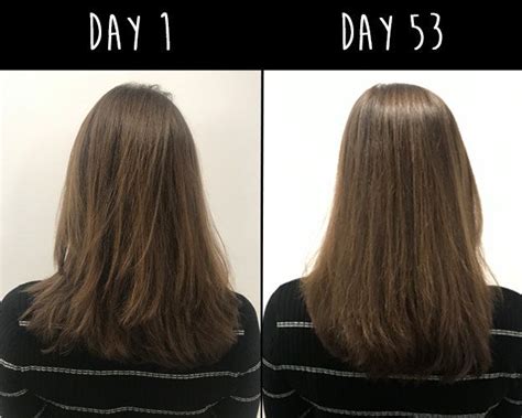 vital proteins hair boost before and after - Kayleen Mcelroy