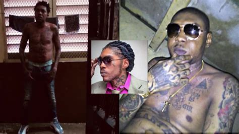 Vybz Kartel facing 'life-threatening' illness in prison amid fight for freedom | FOX 5 New York